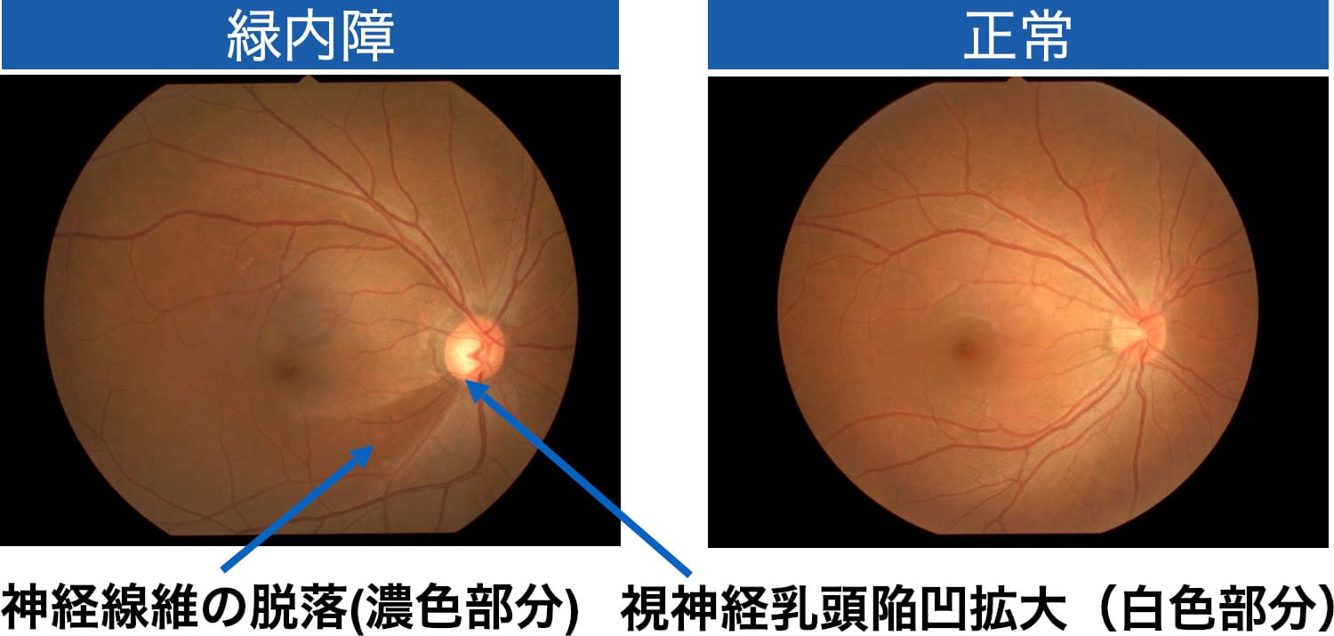 医師に連絡する時期