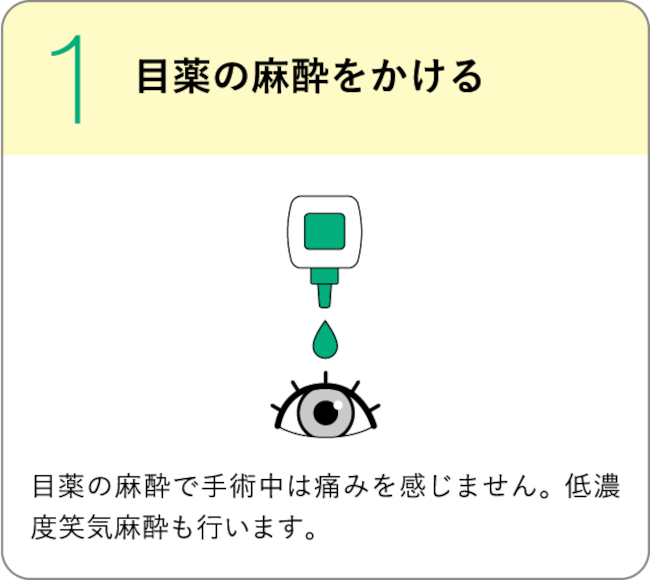 STEP1:目薬の麻酔をかける